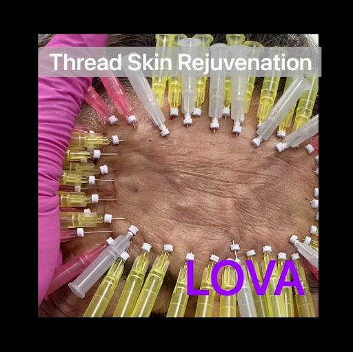 Explore ape tattoo ideas, creative tattoo ideas in Lake Oswego, available at Lake Oswego Vein and Aesthetic LOVA