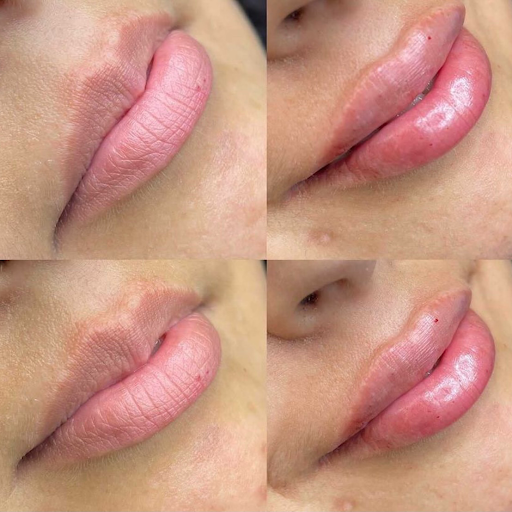 Lifted Beauty Medical Practice image