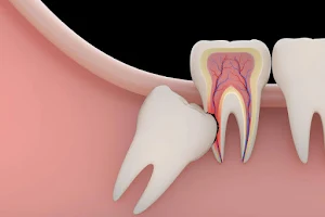 Savarkar Dental Clinic & Implant Centre image