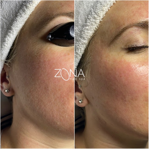 Skin Care Clinic «ZONA MED SPA», reviews and photos, 9767 N 91st St #102, Scottsdale, AZ 85258, USA