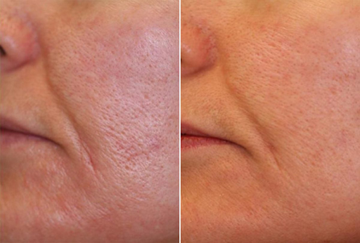 Explore tattoo ideas for hair stylist, creative tattoo ideas in Tucson, available at Allure Medical