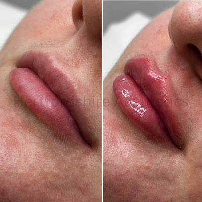 Aesthetics - Aesthetics