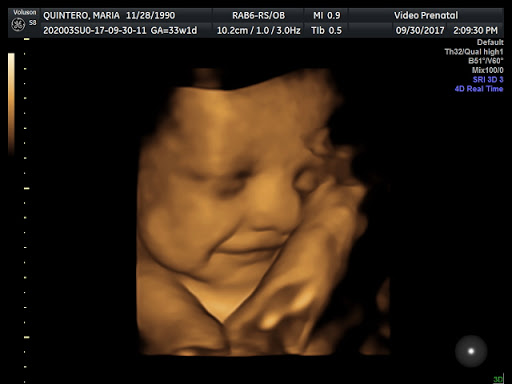 Video Prenatal 3D 4D HD Ultrasound studio