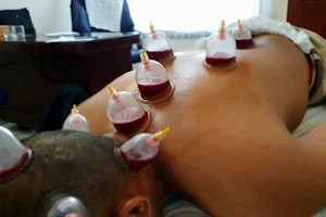 Hijama Planet: Cupping & Ruqyah Center image