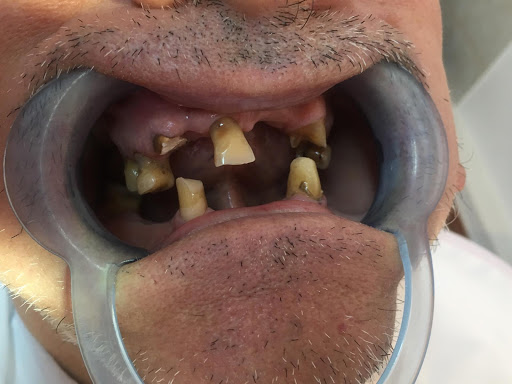 Dent Estetics - Clinica Stomatologica Trapezului, Ortodont Bun Bucuresti | Estetica Dentara Sector 3