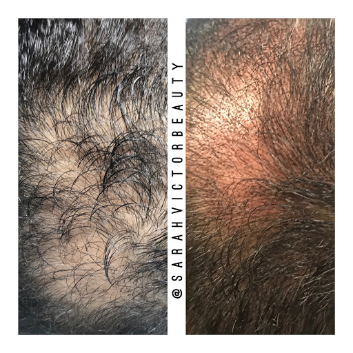 Explore harry potter hand tattoo ideas, creative tattoo ideas in Glastonbury, available at Sarah Victor Studios