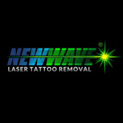 Explore face tattoo cover up ideas, creative tattoo ideas in Bethlehem, available at New Wave Laser Tattoo Removal