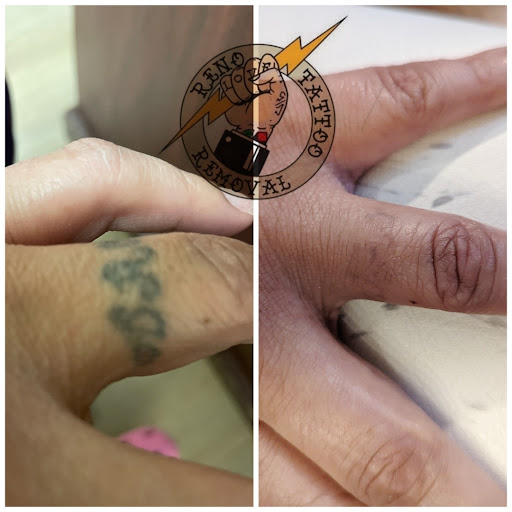 Explore tattoo ideas family, creative tattoo ideas in Reno, available at Reno Tattoo Removal