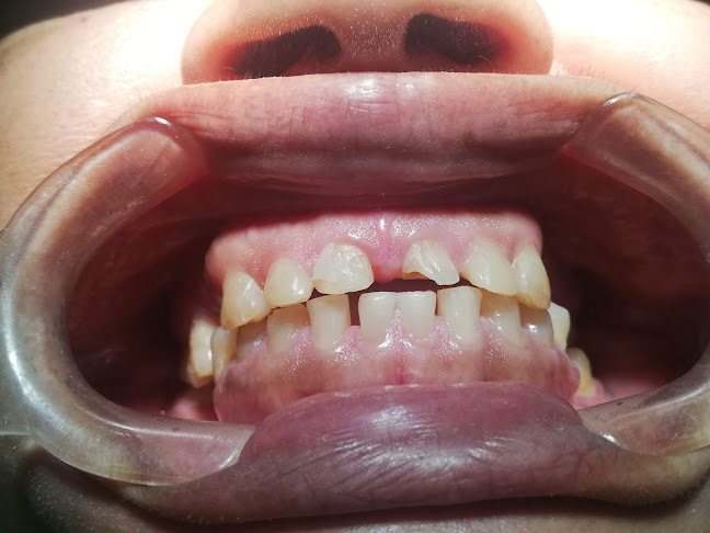 Estudio Dental Villafuerte - Odontólogo en Manta - Manta