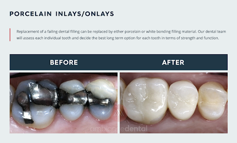 Ambiance Dental - Ambiance Dental