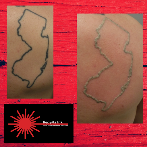 Explore camo tattoo ideas, creative tattoo ideas in Morrisville, available at Regerts Ink Removal