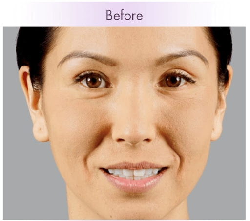 Zormeier Cosmetic Surgery and Longevity Center image