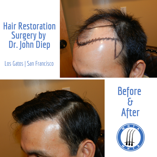 Hair Replacement Service «Medical Hair Transplant & Aesthetics», reviews and photos, 490 Post St #1701, San Francisco, CA 94102, USA