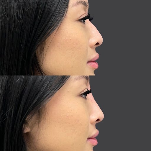 Explore tattoo ideas for son's name, creative tattoo ideas in Whittier, available at Skin Perfect Medical Aesthetics