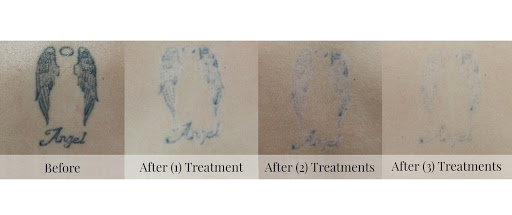 Explore hunting and fishing tattoo ideas, creative tattoo ideas in Adrian, available at TatFreeMD Tattoo Removal Specialists