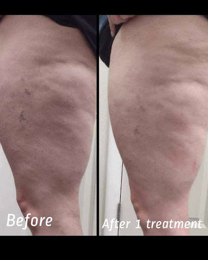 Explore grinch tattoo ideas, creative tattoo ideas in Brighton, available at Tip of the Spear Laser Esthetics