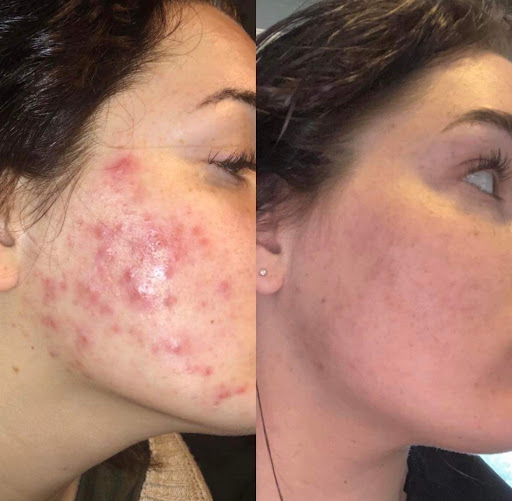 Explore memorial dog tattoo ideas, creative tattoo ideas in Savannah, available at Haute Brows. Cosmetic Tattoo