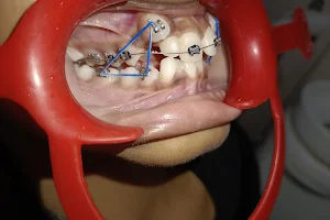 Dr Prajakta Braces and Dental clinic image