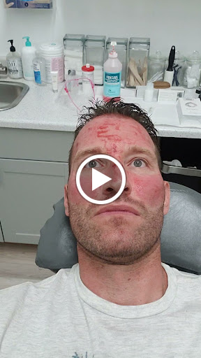 Explore easy to draw tattoo ideas, creative tattoo ideas in Mesa, available at AZ Laser Studio & Medspa