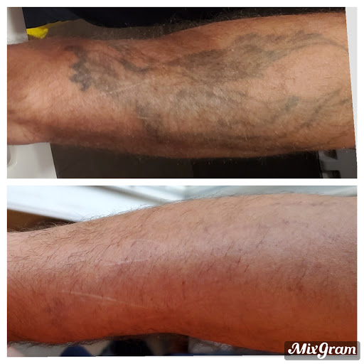 Explore cool tattoo ideas for women, creative tattoo ideas in Longview, available at Vanish Laser Aesthetics