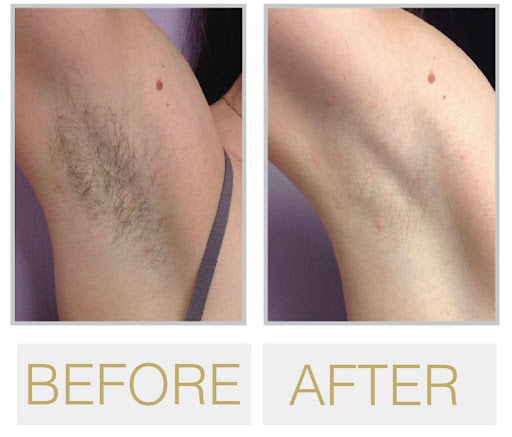 Explore tanjiro tattoo ideas, creative tattoo ideas in Eugene, available at Absolute Laser MD