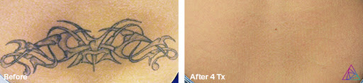 Explore ohio tattoo ideas, creative tattoo ideas in Fort Myers, available at Laser Tattoo Removal by Tatt Cemetery