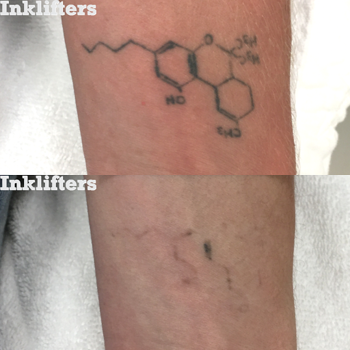 Explore wife tattoo ideas, creative tattoo ideas in Pleasant Grove, available at Inklifters Tattoo Removal