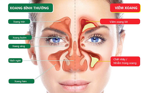 Af1qipprbualb9asm6h1wiylp4lzmo8uweg9vbrhhmyd