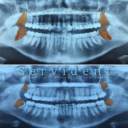 Centro odontologico SERVIDENT - Dentista
