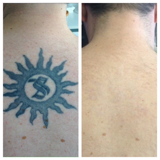 Explore small henna tattoo ideas, creative tattoo ideas in Lawrence, available at Removery Tattoo Removal & Fading