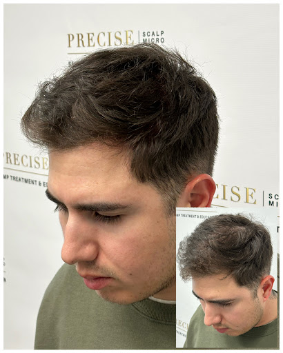 Precise Scalp Micro - Scalp Micropigmentation Service and Training image