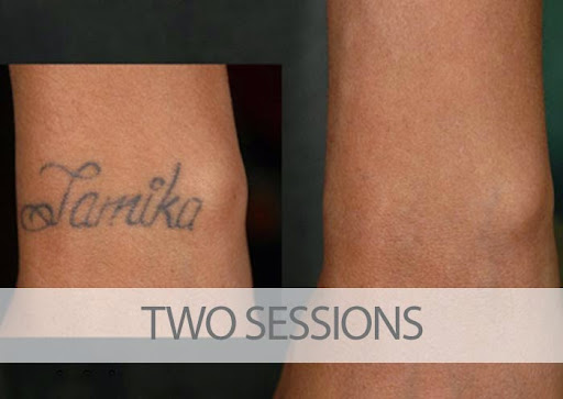 Explore john 13:7 tattoo ideas, creative tattoo ideas in Palm Harbor, available at EradiTatt Tattoo Removal of Palm HarborClearwater