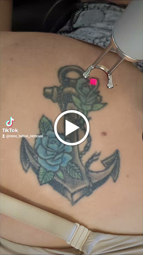 Explore birth tattoo ideas, creative tattoo ideas in Reno, available at Reno Tattoo Removal