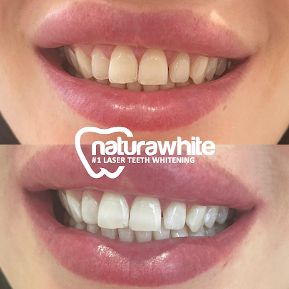 Nr Blue - Teeth Whitening Clinic - Nr Blue - Teeth Whitening Clinic