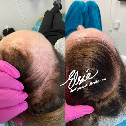SMP Hair Clinic The Queen Of Scalp image