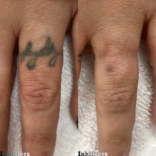 Explore tattoo ideas daisy, creative tattoo ideas in Pleasant Grove, available at Inklifters Tattoo Removal