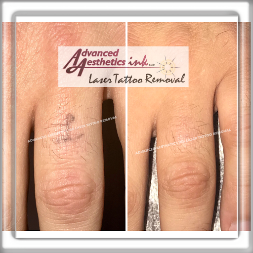 Explore matching father and son tattoo ideas, creative tattoo ideas in South Dartmouth, available at Advanced Aesthetics Ink Laser Tattoo Removal