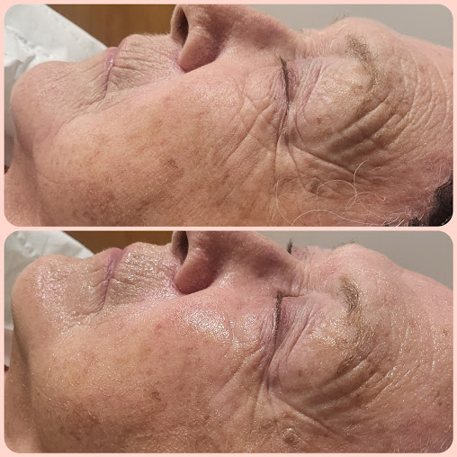 Rejuvenate Skincare Aesthetics - Rejuvenate Skincare Aesthetics