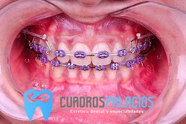Cuadros Palacios Estética dental y especialidades - Manta