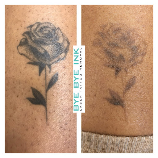 Explore cheating death tattoo ideas, creative tattoo ideas in Middle Village, available at Bye Bye Ink Laser Tattoo Removal