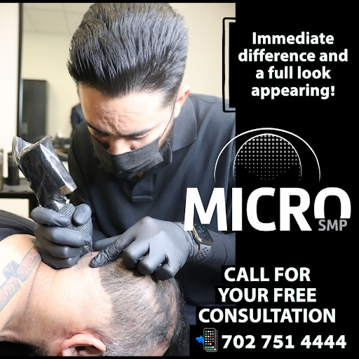MicroSMP Scalp Micropigmentation - Mens Hair loss Solutions