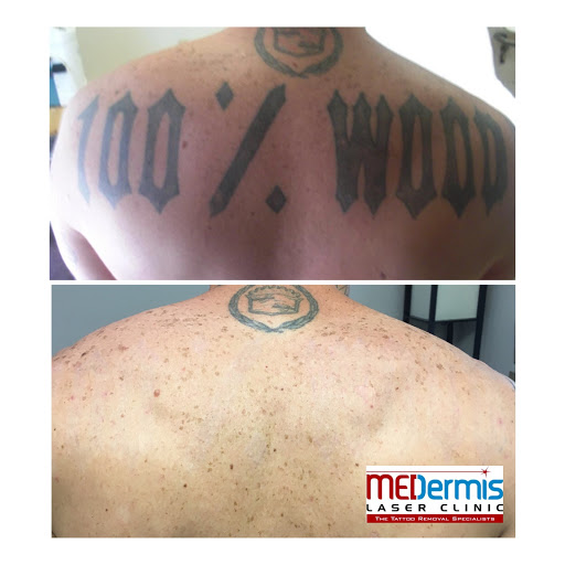 Explore small tattoo idea man, creative tattoo ideas in San Antonio, available at MEDermis Tattoo Removal