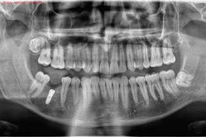 Dr.Bhanu's Dental Care image