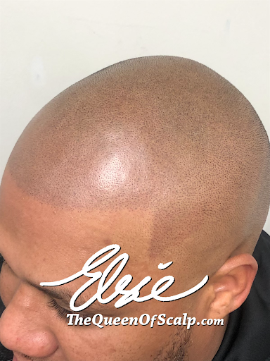 SMP Hair Clinic The Queen Of Scalp image