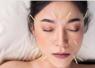 SYNERGIES - Auriculothérapie/ Ventouses/ Acu lift / Acupuncture / Énergétique chinoise à Louviers