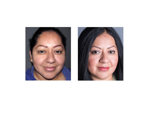 Hair Transplantation Clinic «Bosley Medical - Long Island», reviews and photos, 324 S Service Rd Suite 122, Melville, NY 11747, USA