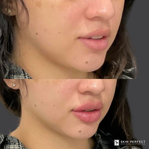 Explore tattoo bible verse ideas, creative tattoo ideas in Whittier, available at Skin Perfect Medical Aesthetics