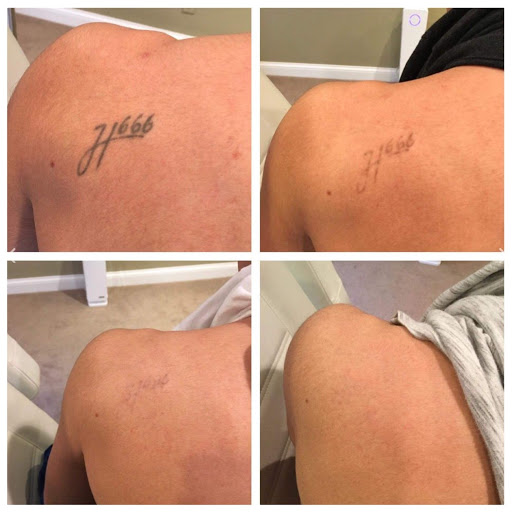 Explore unalome tattoo ideas, creative tattoo ideas in Lexington, available at Lexington Tattoo Removal