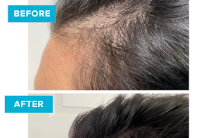 Cellustrious Hair & Skin Rejuvenation image