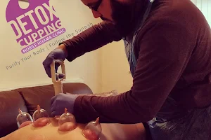 Detox Cupping image